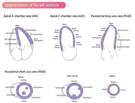 left ventricular wall segment model